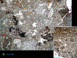 
Chaîne d'observations microscopiques : un outil pour la recherche. Images numériques. Micromorph...
